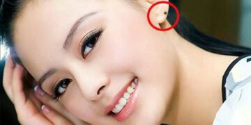 Những con giáp được phú quý nhờ nốt ruồi, đặc biệt trong vận may tài lộc